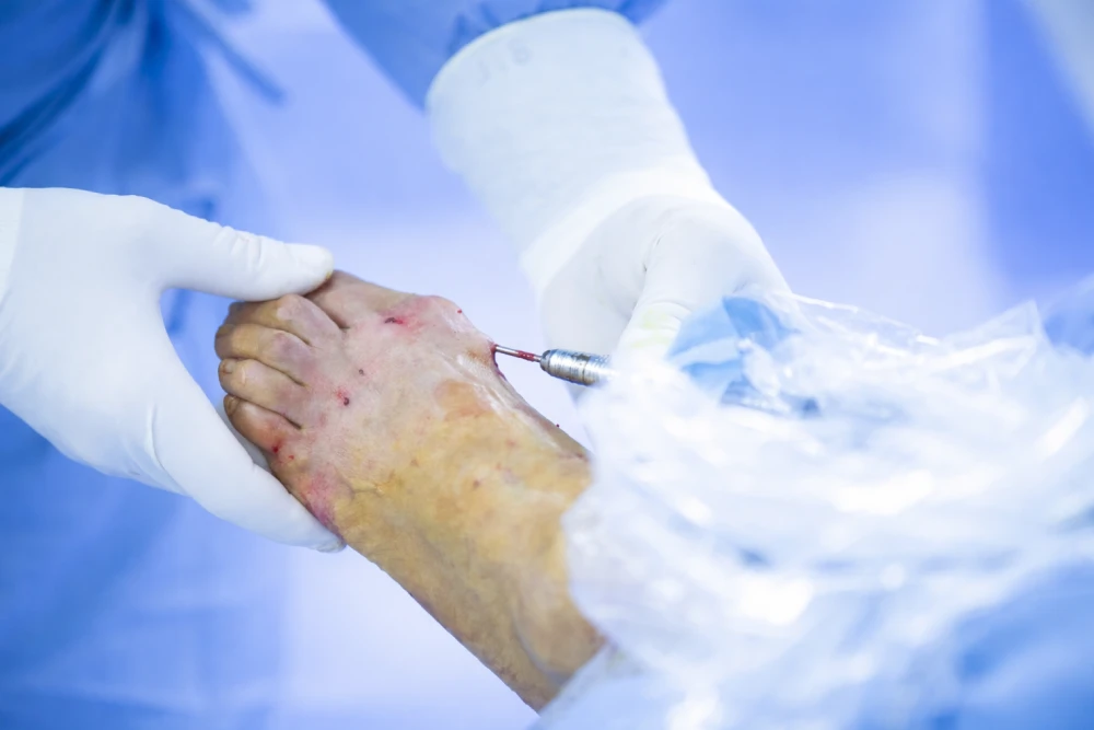 Bunions bunion treatment options aa